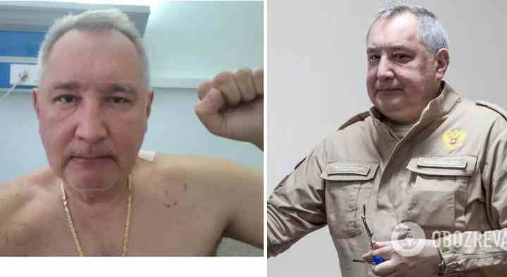 Рогозін показав перше фото після поранення в Донецьку, але є «нюанс»