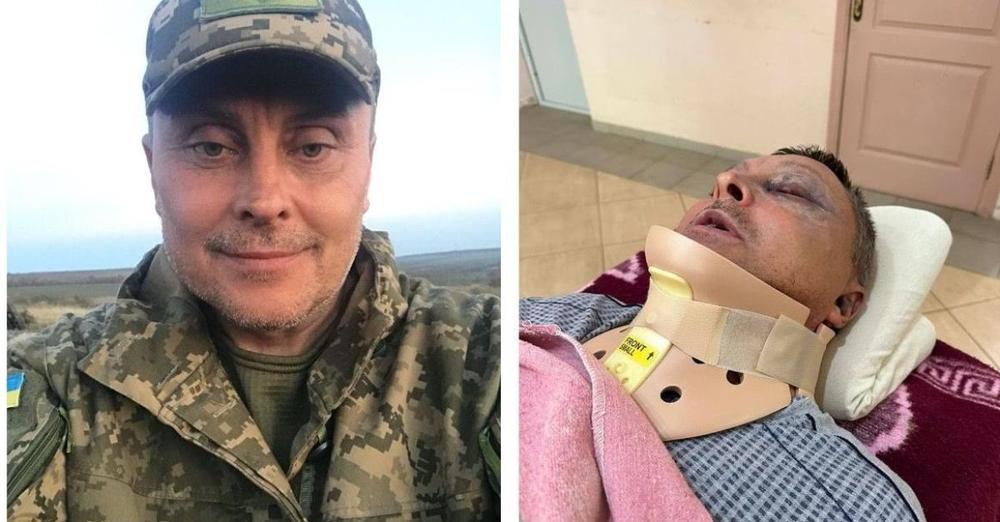 Військовий, якого жорстоко побили на Одещині, помер у лікарні